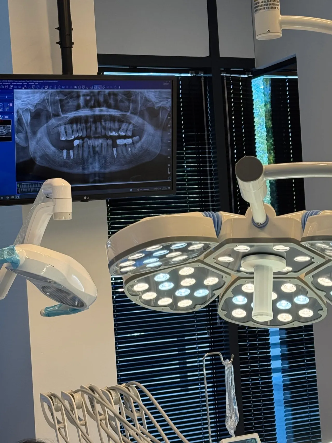 Radiografia panoramica digitale sul monitor dell'ambulatorio Aurum Dentis a Bari