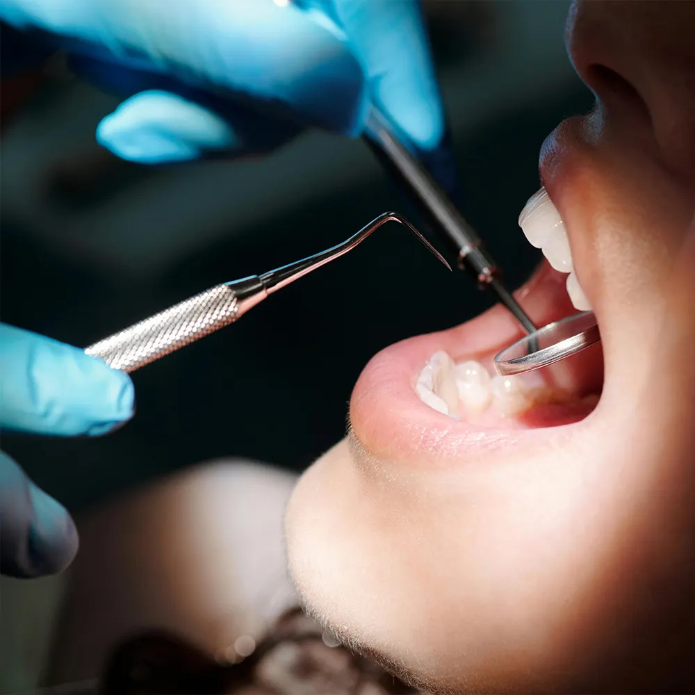 Le fasi di un trattamento implantare eseguito da Aurum Dentis